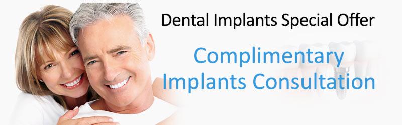 Implants Special Offer